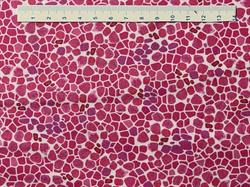 Mosaik på patchworkstof - pink